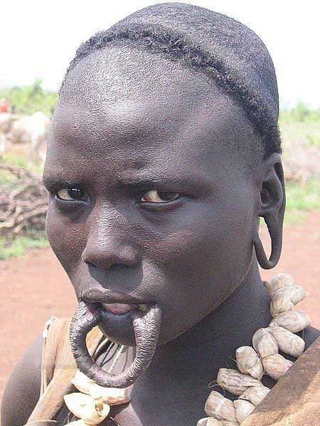 African woman with lip plate removed showing stretched lip