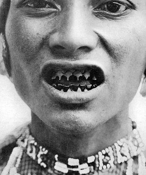 Traditional African sharpened teeth body modification